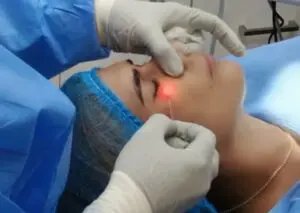 Láser Lifting: la tecnología que rejuvenece tu piel sin cirugía